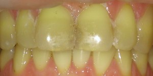 Atvejis 1.jpg redaguota