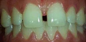 Atvejis 4.jpg pr red